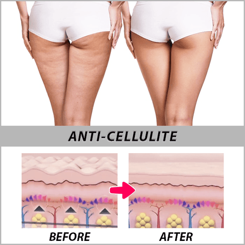 Image of Anti-cellulite Compression Leggings
